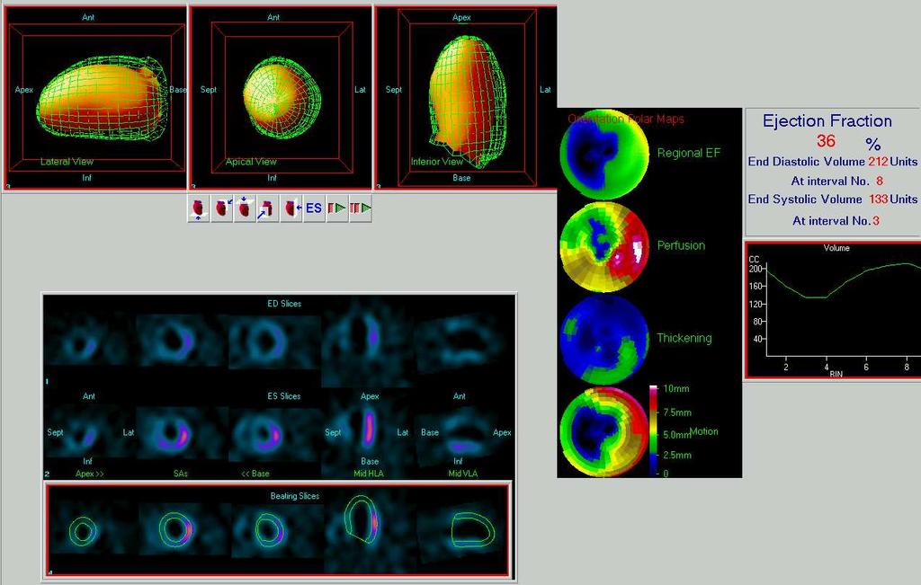 2003;108:1404-1418 J Am Coll Cardiol 2003;42:1318 33 Poslední revize J