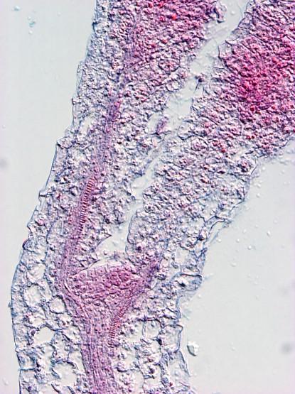 Klíční rostlina Arabidopsis podvojné barvení