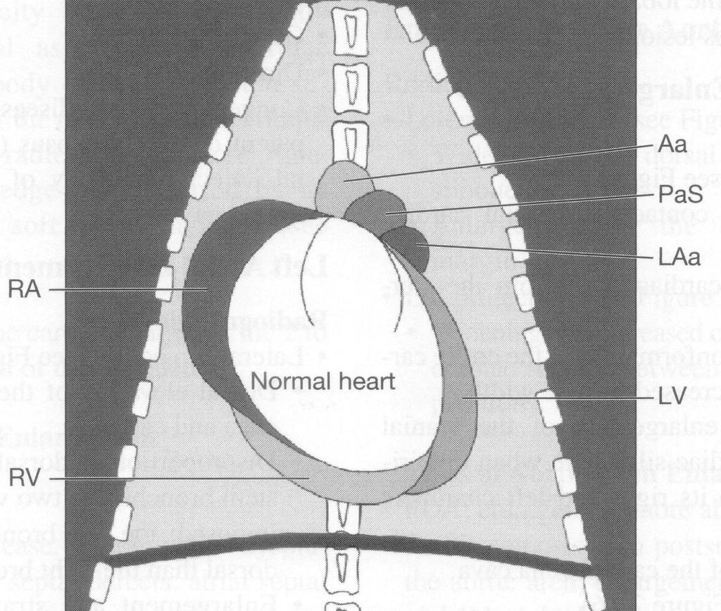 Anatomie srdce v d/v projekci