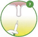 3) Uchopte struk těsně pod jeho bází a vyviňte mírný tlak. 4) Proveďte aplikaci antibiotického přípravku do struku nad úroveň vašich prstů. Vemeno nemasírujte!