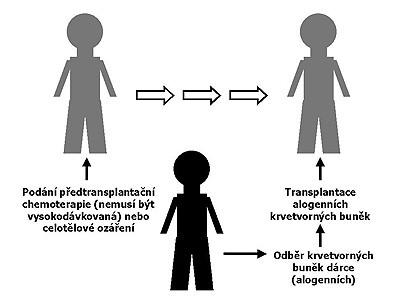 Autologní transplantace