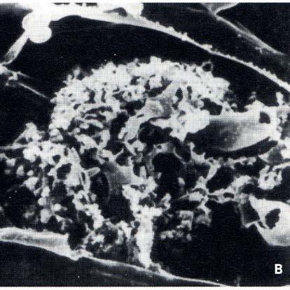 arbuskule tvořená větvenou hyfou Specializované typy kořenů V průběhu evoluce došlo u mnoha rostlinných druhů ke vzniku kořenů, které se specializovaly k některým odlišným funkcím, nebo u nich