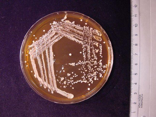 Bakterie s buněčnou stěnou grampozitivního typu Actinobacteria Actinobacteria Bifidobacteriales Bifidobacteriaceae Bifidobacterium Tyčky rozmanitého tvaru, obvykle mírně zakřivené a kyjovité a často