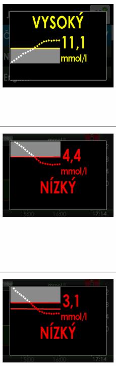 Alarmy - Dexcom Rozsáhlé možnosti nastavení alarmů