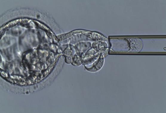 zárodečných buněk u obou partnerů, genetická zátěž). Kdo může být dárcem embryí? Darovaná embrya jsou získána oplo ze ním darovaných oocytů spermatem dárce.