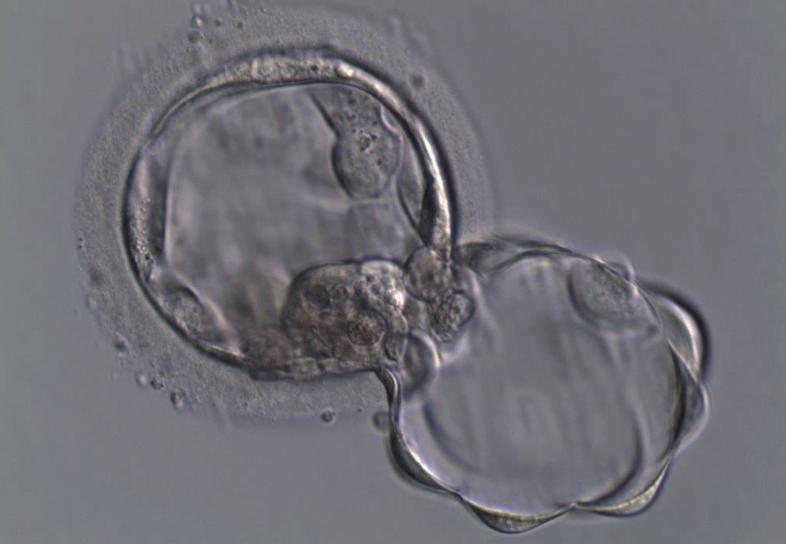 Intaktní žijící spermie, které nevykazují známky fragmentace DNA, pro - tečou kolonou a jsou zachytávány a připraveny pro další použití (ICSI, PICS).