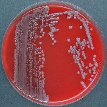 (sdělení HS 2018) Staphylococcus aureus MRSA