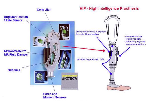 (obr. 2.18). Tento tlumič výrazně zlepšil pohyblivost protézy napodobením přirozené chůze. Kombinace senzorů a regulátoru dokáže přizpůsobit pohyb protézy různým podmínkám jako např.