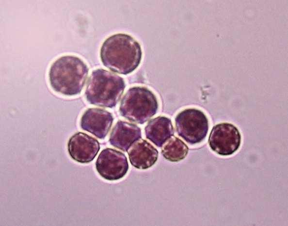 Oddělení Rhodophyta (ruduchy) Třída Porphyridiophyceae cvičení 3,