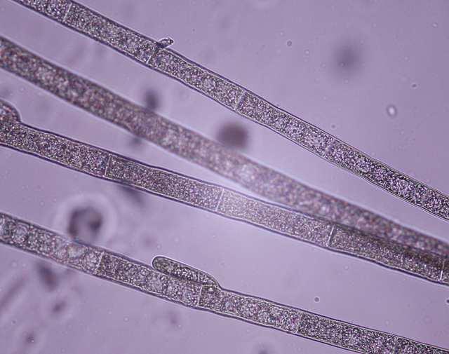 Oddělení Rhodophyta (ruduchy) Třída Florideophyceae* Řád Acrochaetiales mořské i