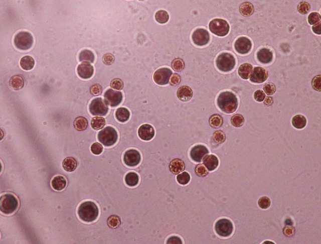 Oddělení Rhodophyta (ruduchy) Třída Porphyridiophyceae* Řád Porphyridiales