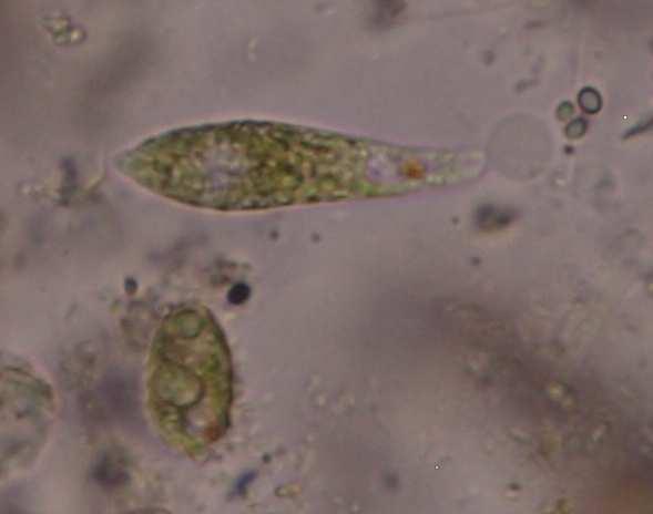 Třída Euglenophycae(krásnoočka) cvičení 2, vzorek 1