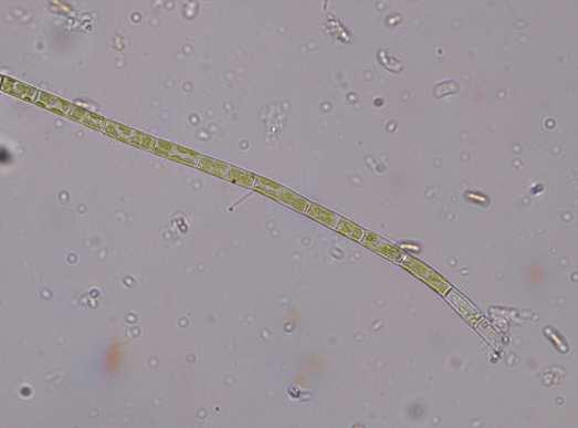 Třída Xanthophyceae (různobrvky) Řád Tribonematales v našich sladkých vodách je hojný rod Tribonema s