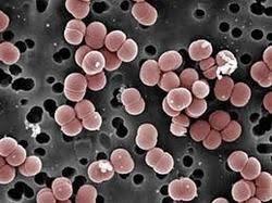 Bakteriální rezistence závažný celosvětový problém zvyšuje morbiditu, mortalitu,