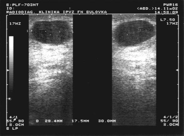 Sonografie Ohraničené