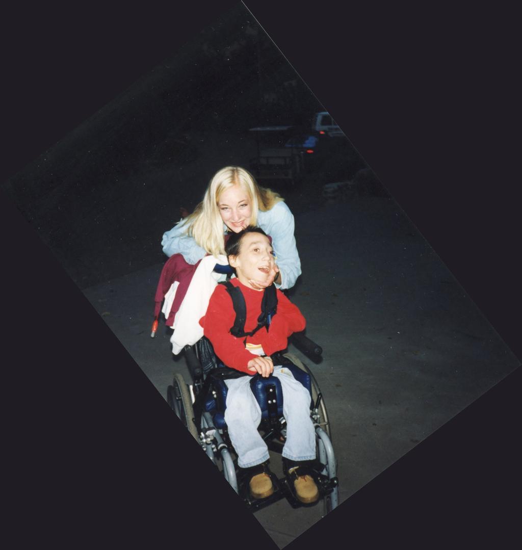 Příčiny pohybového handicapu /příklady/ spina bifida dětská mozková obrna svalové dystrofie myopatie poranění míchy
