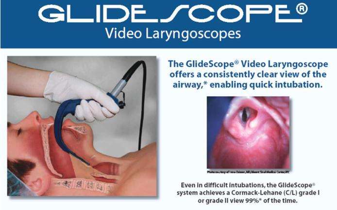 videolaryngoskop Glydescope, 3