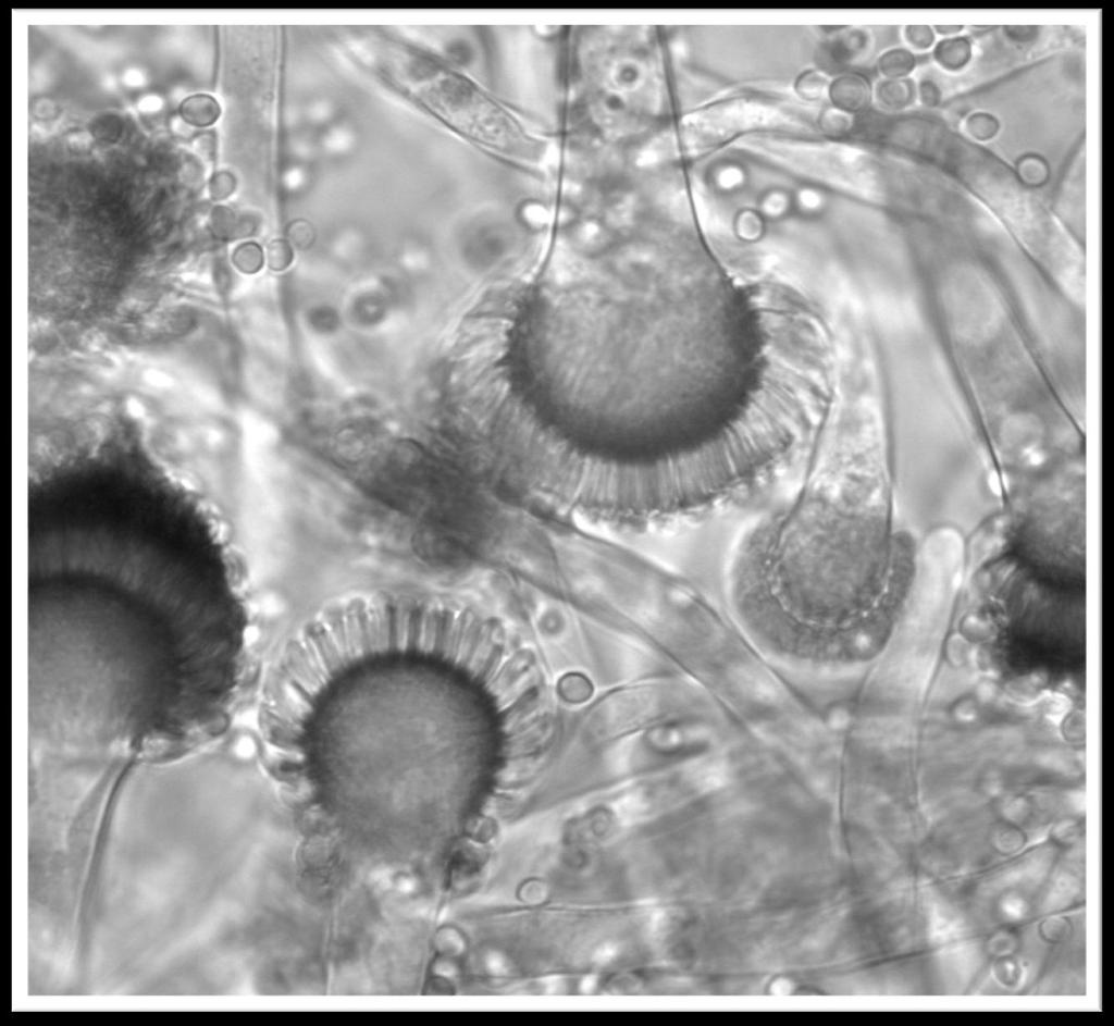 2009 2011, 21 center v 18 zemích 3788 Aspergillus sp., 77,6 % A.