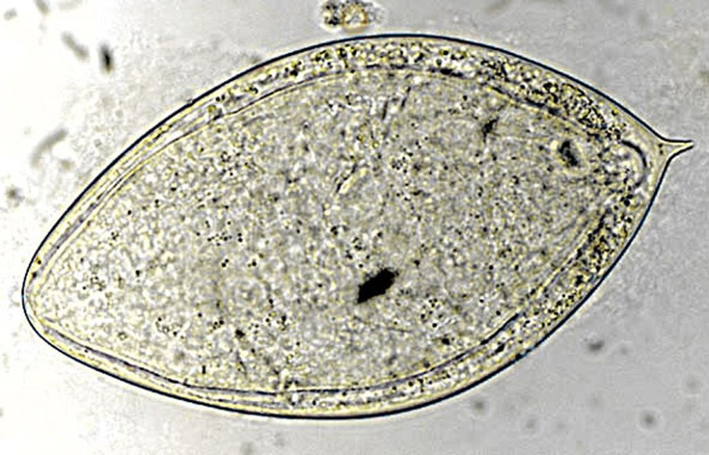 Schistosoma haematobium s vajíčkem