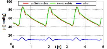 13 Příklad tlakových křivek naměřených na mechanickém modelu kardiovaskulárního systému (upraveno z [19]) 4.2.3 Mechanický model vs.