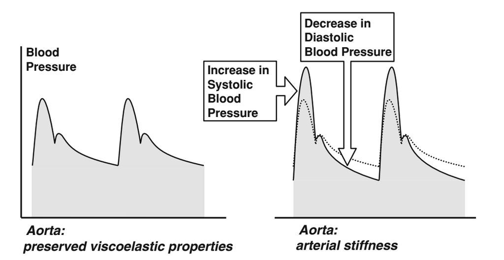 Arterial stiffness and