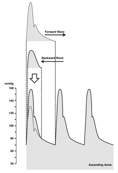 Ascendentní aorta + normální elasticita