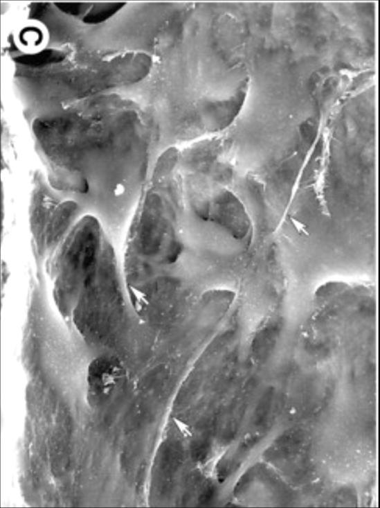 endothelium with lumen