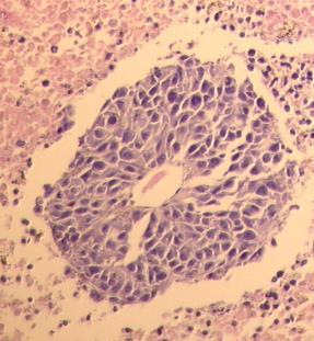 angiogenic and angiogenesis-dependent (Folkman 1971)