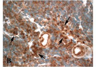 beta-cateninu cca ¼