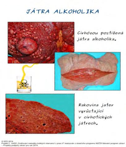 PACIENTŮ Proškolení a materiály zdarma