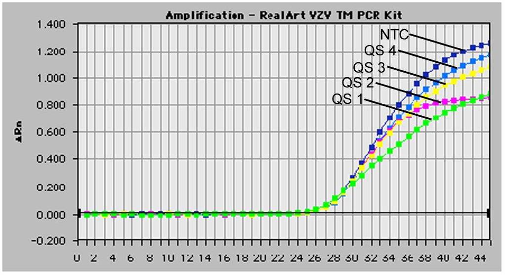 26: Prkaz Interní kontroly (IC) detekcí fluorescenního signálu VIC (ABI PRISM 7700 SDS) pi