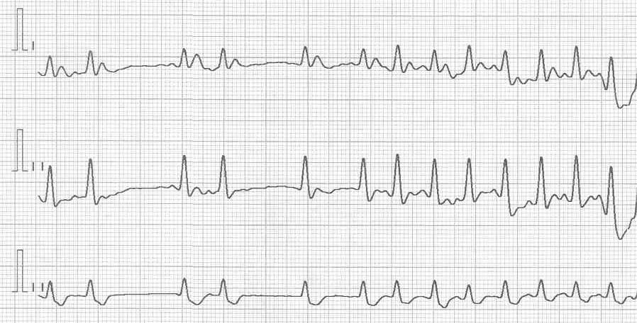 ECG in a ferret with