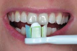Jak správně čistit zuby sonickým kartáčkem Aplikace zubní pasty Na