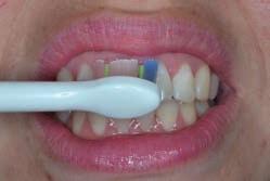 zubní pasty s nízkou abrazivitou, která je citlivá k vašim zubům a