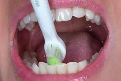 Na čištění vnitřních plošek zubů v dolní čelisti si dejte záležet.