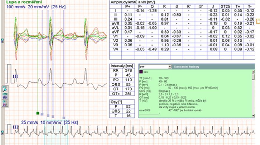 Monitor nebo