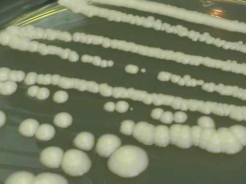 Rod Saccharomyces Fungi, Ascomycota, Saccharomycotina, Saccharomycetes, Saccharomycetidae, Saccharomycetales, Saccharomycetaceae dlouho považován za