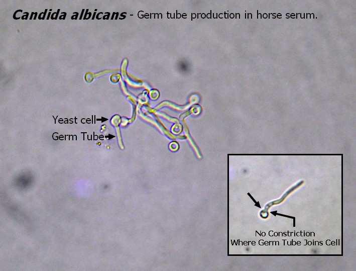 Candida albicans Morfologie záleží na typu substrátu tvoří blastokonidie,