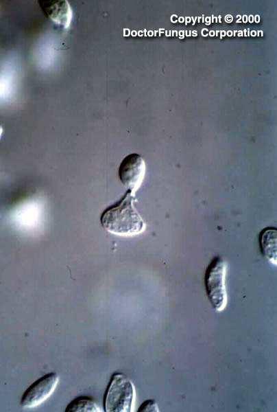 Rod Sporobolomyces Fungi, Basidiomycota, Pucciniomycotina, Microbotryomycetes, Sporidiobolales rozšířen v životním prostředí (lidé, savci, ptáci, a rostliny) běžně