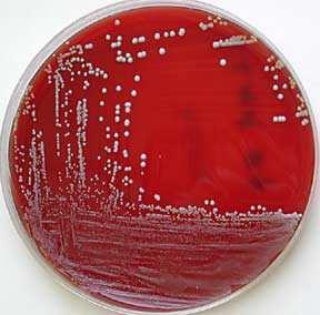 Candida albicans Kultivace vhodná kultivační teplota je 30-37 C doba kultivace 24 48 hodin schopnost růstu při 40-45 C na baktriologických půdách