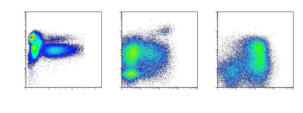 CD45 Transientní myeloproliferace (TMD) CD7 CD34 TMD=transientní myeloproliferace u pacientů s m.