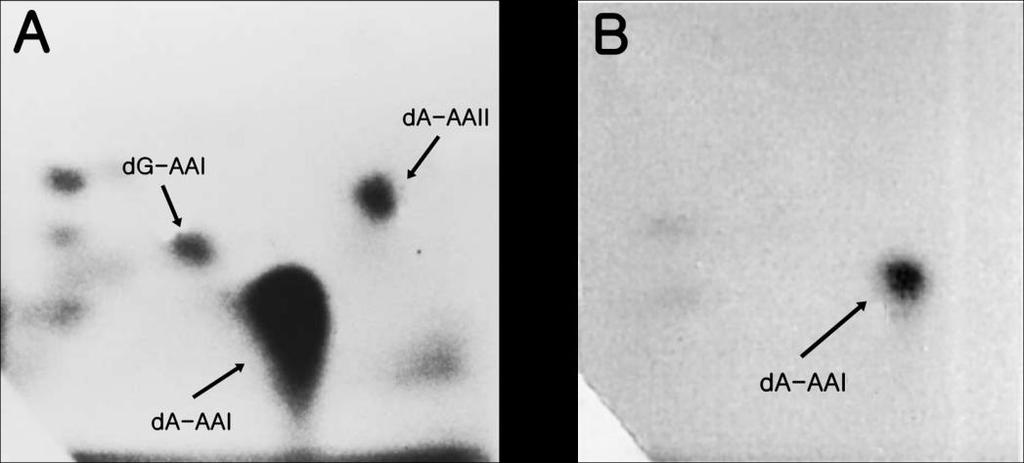 Úvod br. 11: Autoradiogram aduktů AA s DNA analysovaných metodou 32 P-postlabelling v ledvinách pacientů postižených AAN (A) a BEN (B) (převzato z Nortier et al., 2000; Arlt et al., 2002b).