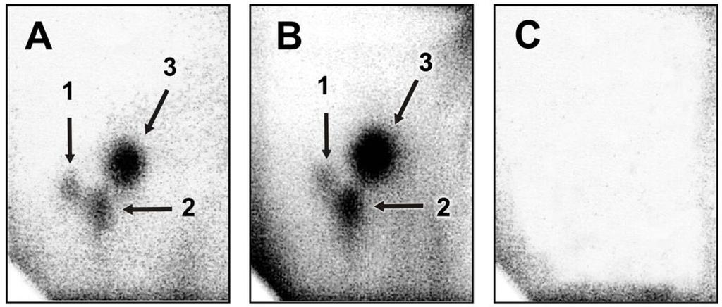 Výsledky br. 52: Autoradiogramy aduktů AA (A a B) a TA (C) s DNA v játrech potkanů premedikovaných AA (A), TA a AA (B) a TA samotným (C). Skvrna 1, dg-aai; skvrna 2, da-aai a skvrna 3, da-aaii.