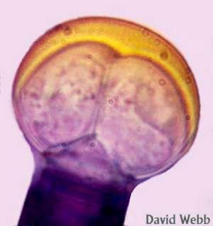 trichomy Krycí pletiva: žlaznaté trichomy Types of trichomes: unicellular