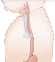 Jícen (oesophagus) Novorozenec jícen odpovídá téměř dospělým leží o něco výše od C 3 až C 5 kardie Th 11
