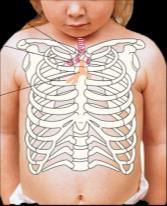 vocalia, poté hlasové chrupavky) Průdušnice a průdušky (trachea, bronchi)