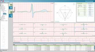 1 klidové EKG PADSY-ECG klidové počítačové EKG CardioPort Four Medset ECG-Top Počítačové EKG Medset ECG-Top