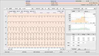 spojení pro kompletní volnost custo stress EKG řídí medicínsky certifikované ergometry a běhací pásy (ergoline či Lode, viz strany 20-25) zápěsťový oxymetr WristOx 2 pro