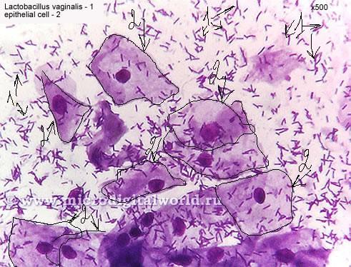 Normální mikroflóra: epitelie, laktobacily (Döderleinův bacil) Giemsa Ve skutečnosti lze za normální