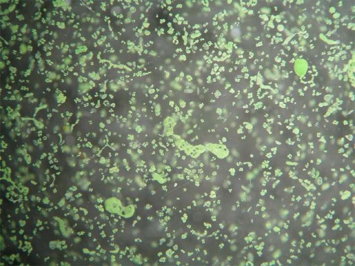 Microcystis Státní